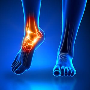 Contact Atlantic Orthopaedics for Podiatry Services in Portsmouth NH and York ME