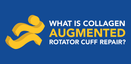 Running person icon to the left of the image and to the right is the blog title: What is Collagen Augmented Rotator Cuff Repair?
