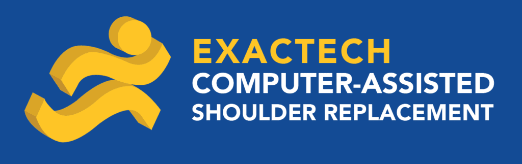 Exactech Computer-Assisted Shoulder Replacement