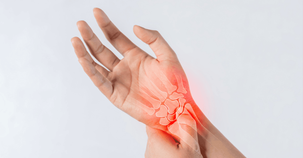 Wrist Fracture Treatment: Why Prompt Care Matters for Recovery 